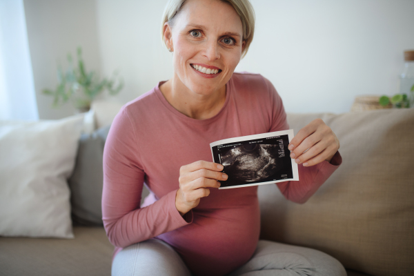 Pregnant woman showing ultrasound photo of a baby.