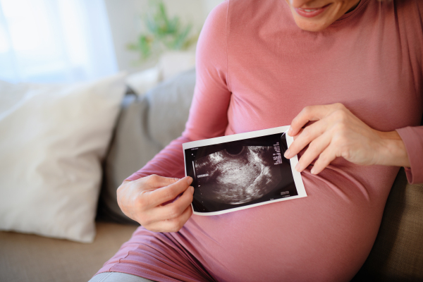 Pregnant woman showing ultrasound photo of a baby.