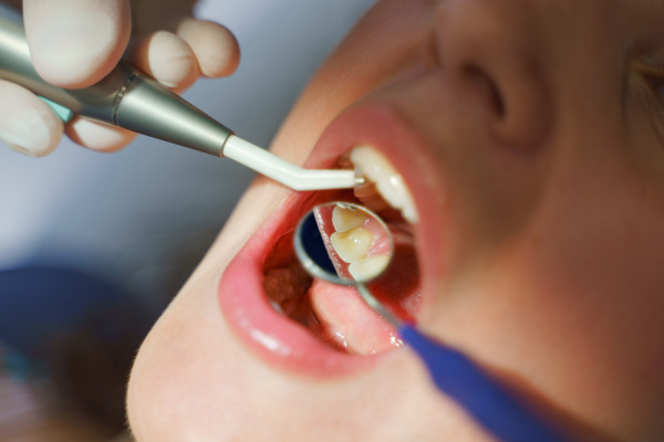 Close-up of young woman at dental examination in an ambulance.