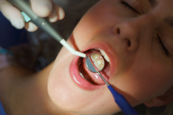 Close-up of dental examination in an ambulance.