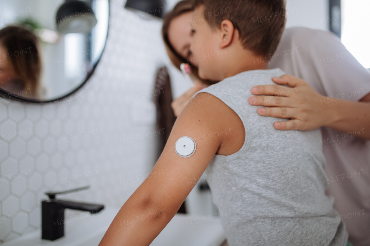 The diabetic boy brushing his teeth in the morning, preparing for the day, while wearing a continuous glucose monitoring sensor on his arm. CGM device making life of school boy easier, helping manage his illness and focus on other activities.