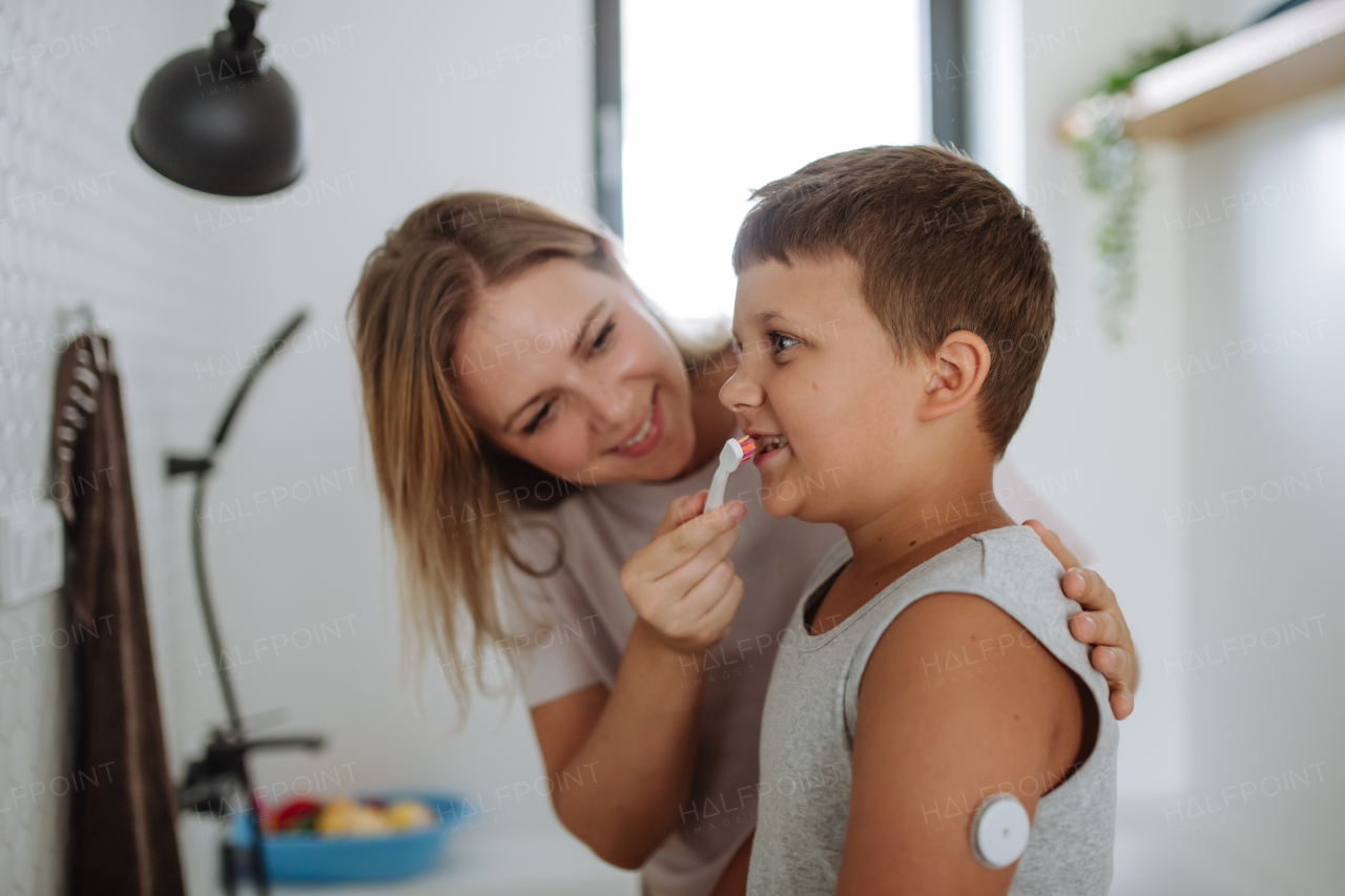 Mother helping diabetic boy to brush his teeth in the morning, while wearing a continuous glucose monitoring sensor on his arm. CGM device making life of school boy easier, helping manage his illness and focus on other activities.