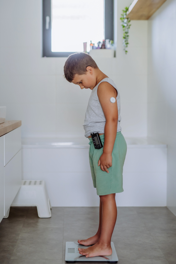 A young boy with diabetes weighing himself on bathroom scale. The need for weight control in pediatric diabetic patients. Boy using continuous glucose monitor.