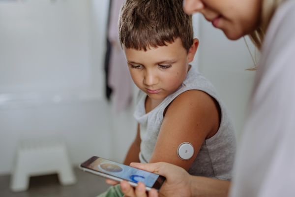 Mother of diabetic boy checking his blood glucose level at home using continuous glucose monitor. Mother connecting his CGM to a smartphone to monitor his blood sugar levels in real time.