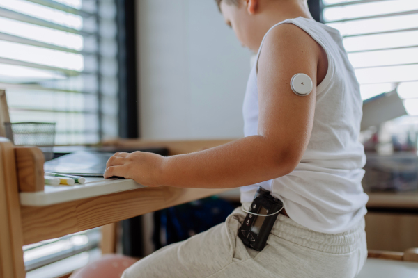 The diabetic boy doing homework, while wearing a continuous glucose monitoring sensor on his arm. CGM device making life of school boy easier, helping manage his illness and focus on other activities.