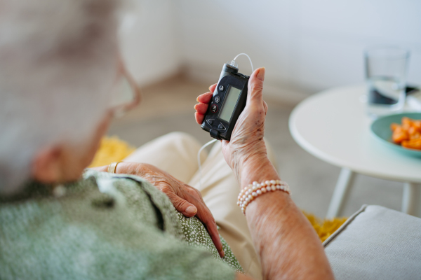 Close up of diabetic senior patient checking her blood sugar level on insulin pump. Portrait of senior woman with type 1 diabetes taking insuling from tethered insulin pump.