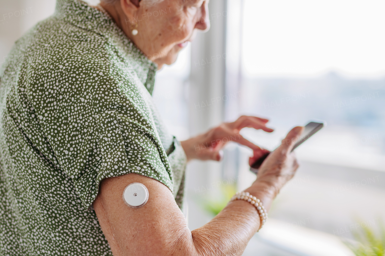 Diabetic senior patient using continuous glucose monitor to check blood sugar level at home. CGM device making life of elderly woman easier, helping manage her illness and focus on other activities. Senior diabetic woman checking her glucose data on smartphone.