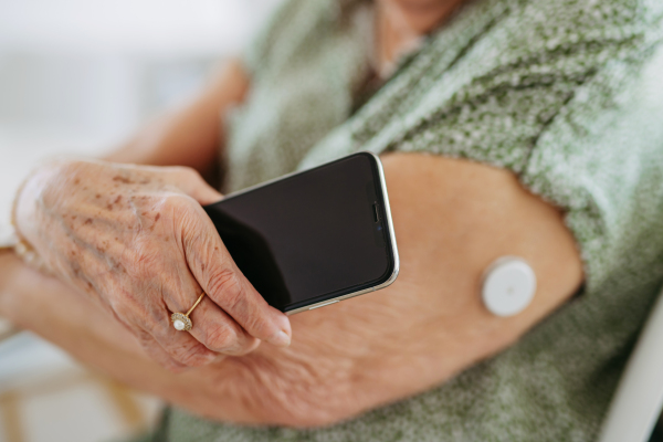 Close up of diabetic senior patient checking blood glucose level at home using continuous glucose monitor. Elderly woman connecting her CGM with smarphone to see her blood sugar levels in real time.