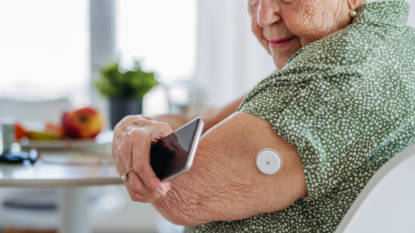 Diabetic senior patient checking blood glucose level at home using continuous glucose monitor. Elderly woman connecting her CGM with smarphone to see her blood sugar levels in real time.