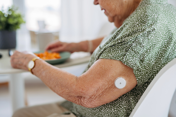 Close up of continuous glucose monitor on senior woman's upper arm. Diabetic senior patient using continuous glucose monitor to control blood sugar level at home. CGM device making life of elderly woman easier, helping manage her illness and focus on other activities.