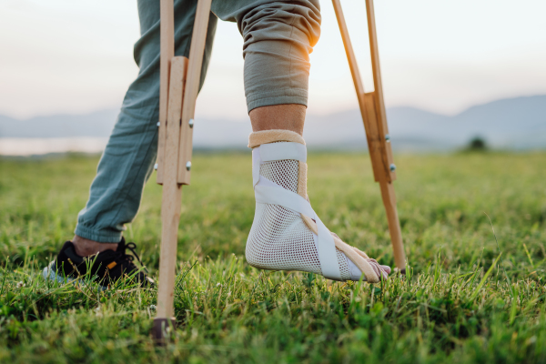 Close up of broken ankle in cast brace Man standing on healthy leg, while broken leg is in synthetic cast, supported with crutches.