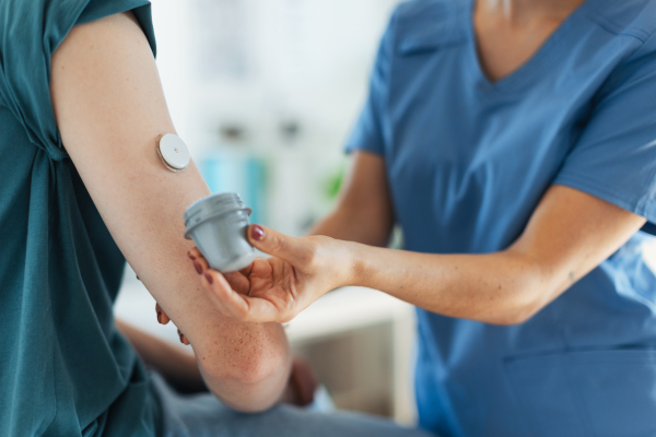 Diabetologist doctor, nurse applying a continuous glucose monitor sensor on arm of a diabetic teenager. CGM device making life of teenage boy easier, helping manage his illness and focus on other activities.