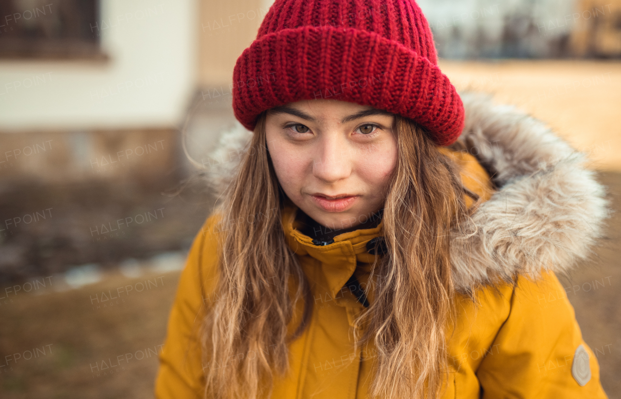 A close-up of young woman with Down syndrome weraing hood and looking at camera