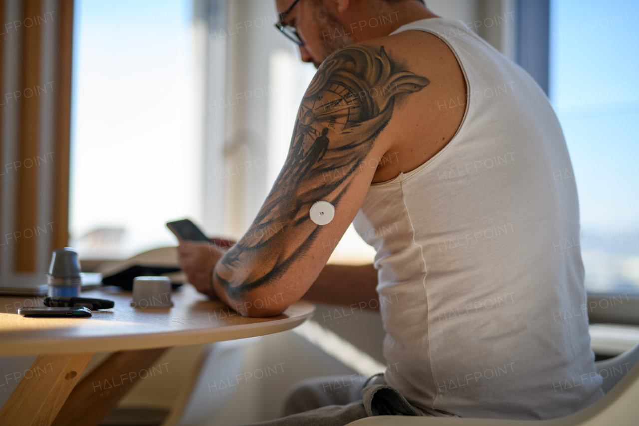 Diabetic man with CGM sensor is checking blood glucose level using smartphone app.