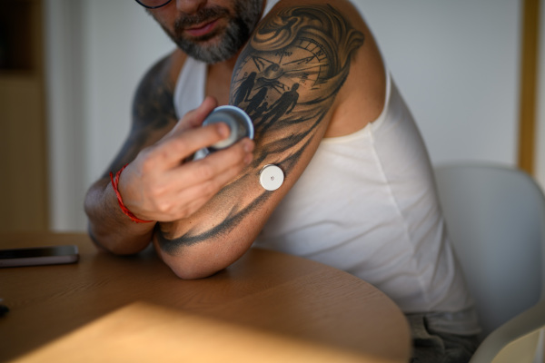 Close up of diabetic man using sensor applicator to insert the CGM sensor into his arm.