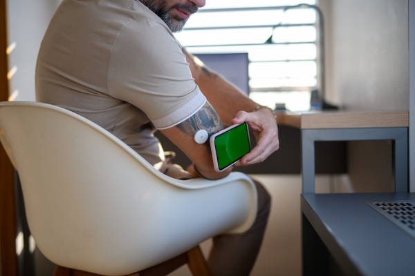 Diabetic man with CGM sensor is checking blood glucose level using smartphone app.