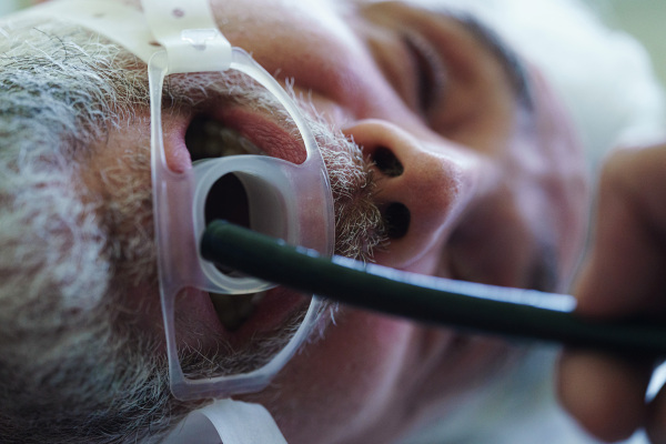 Close up of gastroscopy procedure on sedated patient to examine upper digestive tract. Medical procedure.
