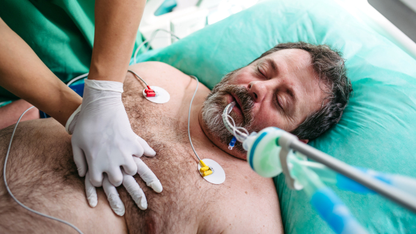Medical team doing CPR on intubated patient in hospital.