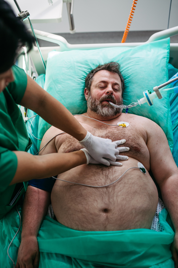 Medical team doing CPR on intubated patient in hospital.