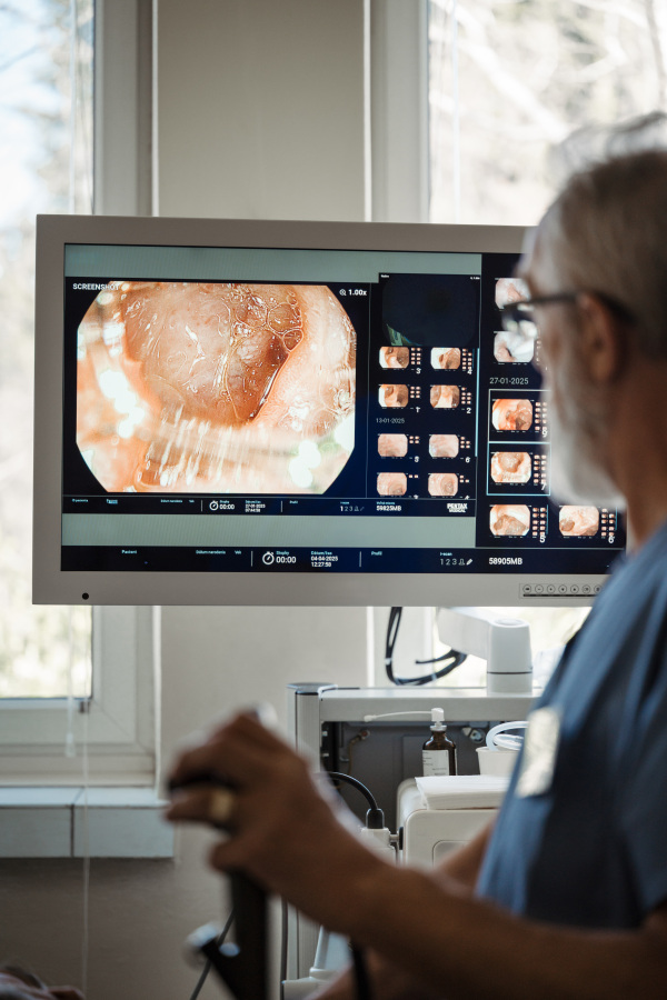 Doctor looking at monitior during gastroscopy procedure, examining upper digestive tract. Medical procedure.
